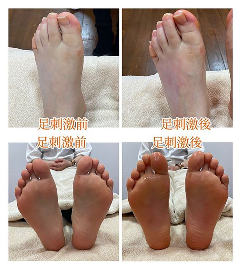 【FYTTE web連載/偏頭痛が解消し寝つきも改善!】